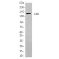 U-Blot® FAK Rabbit Monoclonal Antibody – Figure 1 of 3