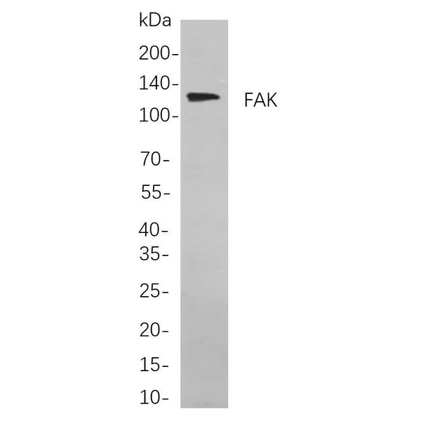 U-Blot® FAK Rabbit Monoclonal Antibody – Figure 1 of 3