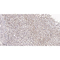 U-Blot® Mucin 5AC Rabbit Monoclonal Antibody – Figure 1 of 2