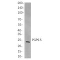 U-Blot® NDUFB8 Rabbit Monoclonal Antibody – Figure 1 of 1