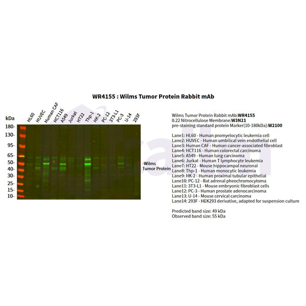 U-Blot® Wilms Tumor Protein Rabbit Monoclonal Antibody – Figure 1 of 2
