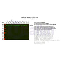 U-Blot® ROCK1 Rabbit Monoclonal Antibody – Figure 1 of 3