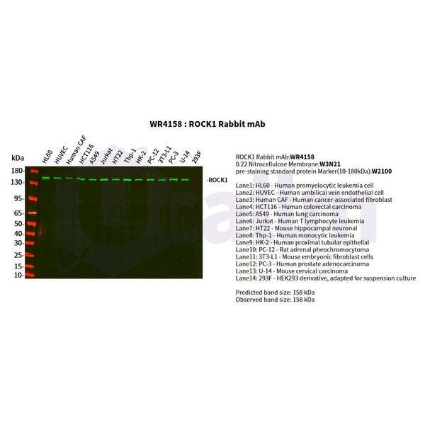 U-Blot® ROCK1 Rabbit Monoclonal Antibody – Figure 1 of 3