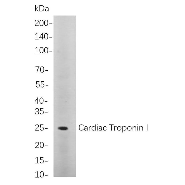 U-Blot® Cardiac Troponin I Rabbit Monoclonal Antibody – Figure 1 of 1