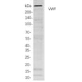 U-Blot® VWF Rabbit Monoclonal Antibody (PT0316R) – Figure 1 of 1