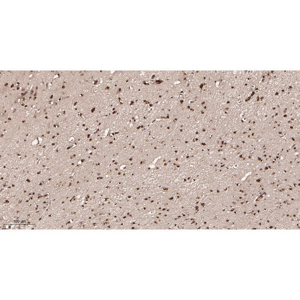 U-Blot® p27 KIP 1 Rabbit Monoclonal Antibody – Figure 1 of 3
