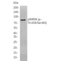 U-Blot® FOXP1 Rabbit Monoclonal Antibody – Figure 1 of 1
