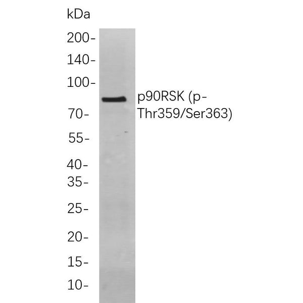 U-Blot® FOXP1 Rabbit Monoclonal Antibody – Figure 1 of 1