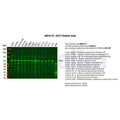U-Blot® ATG7 Rabbit Monoclonal Antibody – Figure 1 of 2