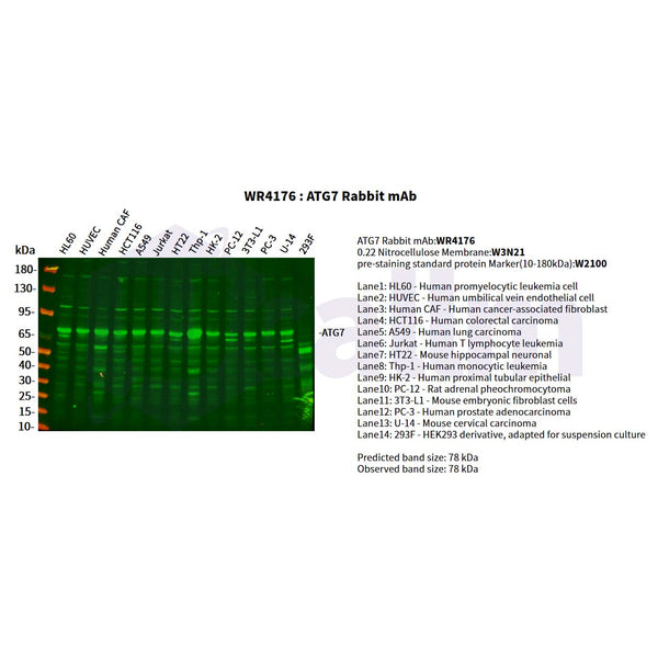 U-Blot® ATG7 Rabbit Monoclonal Antibody – Figure 1 of 2