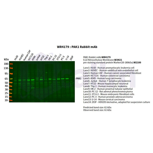U-Blot® PAK1 Rabbit Monoclonal Antibody – Figure 1 of 2