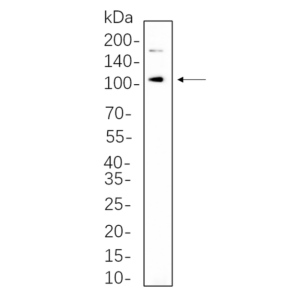 U-Blot® IRE1α Rabbit Monoclonal Antibody – Figure 1 of 1