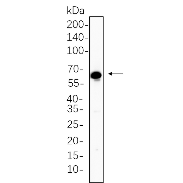 U-Blot® TGF β Receptor II Rabbit Monoclonal Antibody – Figure 1 of 1