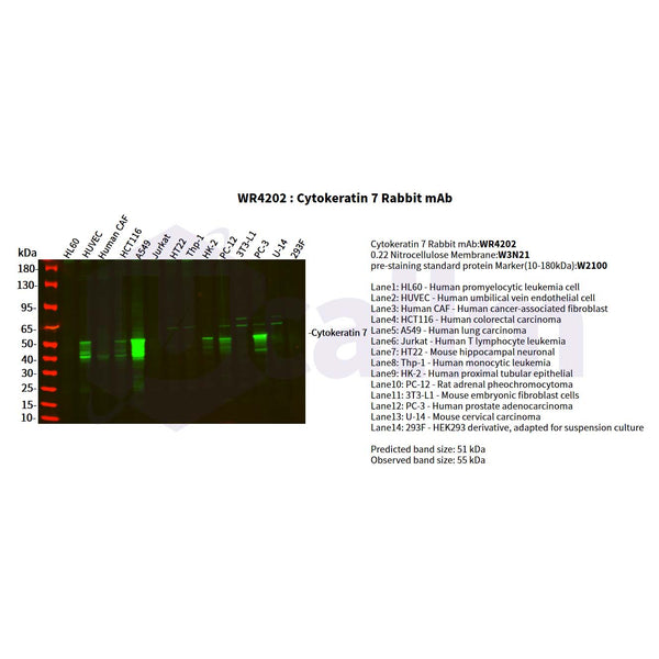 U-Blot® Cytokeratin 7 Rabbit Monoclonal Antibody – Figure 1 of 3