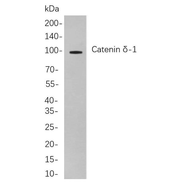 U-Blot® CD10 Rabbit Monoclonal Antibody – Figure 1 of 1