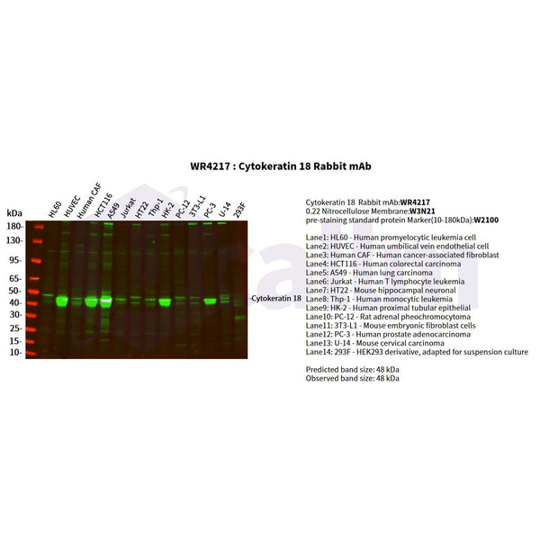 U-Blot® Cytokeratin 18 Rabbit Monoclonal Antibody – Figure 1 of 3