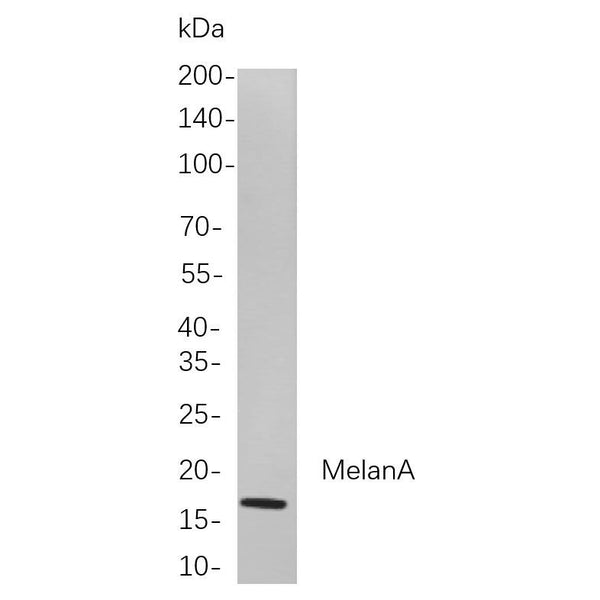 U-Blot® Myosin Light Chain 2 Rabbit Monoclonal Antibody – Figure 1 of 1