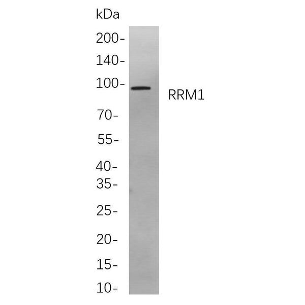U-Blot® β Catenin (Phospho Ser675) Rabbit Monoclonal Antibody – Figure 1 of 1
