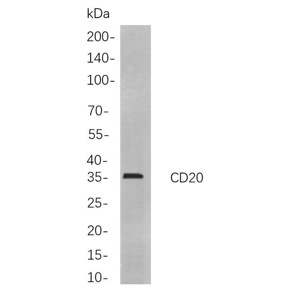 U-Blot® CD20 Rabbit Monoclonal Antibody (PT0419R) – Figure 1 of 1