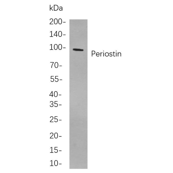 U-Blot® Periostin Rabbit Monoclonal Antibody – Figure 1 of 1