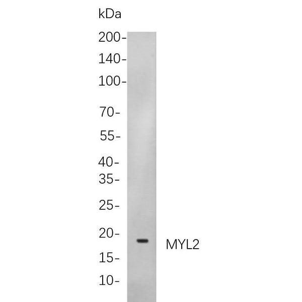 U-Blot® MelanA Rabbit Monoclonal Antibody – Figure 1 of 1