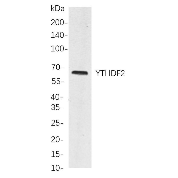 U-Blot® Paxillin (Phospho Tyr118) Rabbit Monoclonal Antibody – Figure 1 of 1