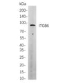 U-Blot® ITGB6 Rabbit Monoclonal Antibody – Figure 1 of 1