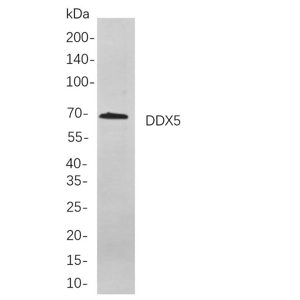 U-Blot® Oct-2 Rabbit Monoclonal Antibody – Figure 1 of 1