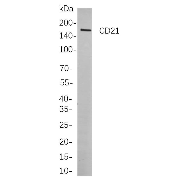 U-Blot® CD21 Rabbit Monoclonal Antibody – Figure 1 of 1