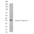 U-Blot® Cardiac Troponin T Rabbit Monoclonal Antibody – Figure 1 of 1