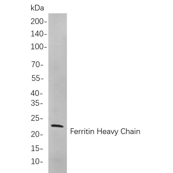 U-Blot® MYL9 Rabbit Monoclonal Antibody – Figure 1 of 1