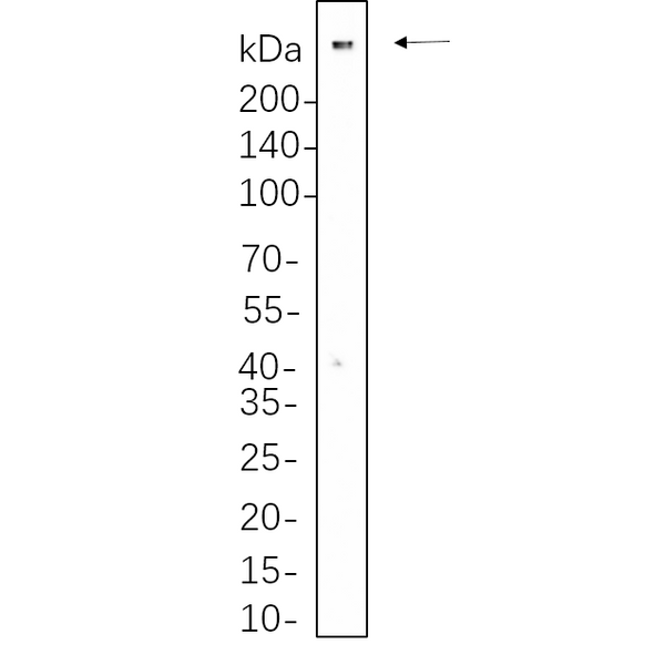 U-Blot® 53BP1 Rabbit Monoclonal Antibody – Figure 1 of 1