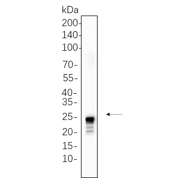 U-Blot® TAGLN Rabbit Monoclonal Antibody – Figure 1 of 1