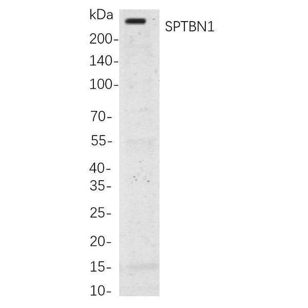 U-Blot® LRP6 Rabbit Monoclonal Antibody – Figure 1 of 1