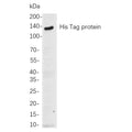 U-Blot® His Tag Rabbit Monoclonal Antibody – Figure 1 of 1
