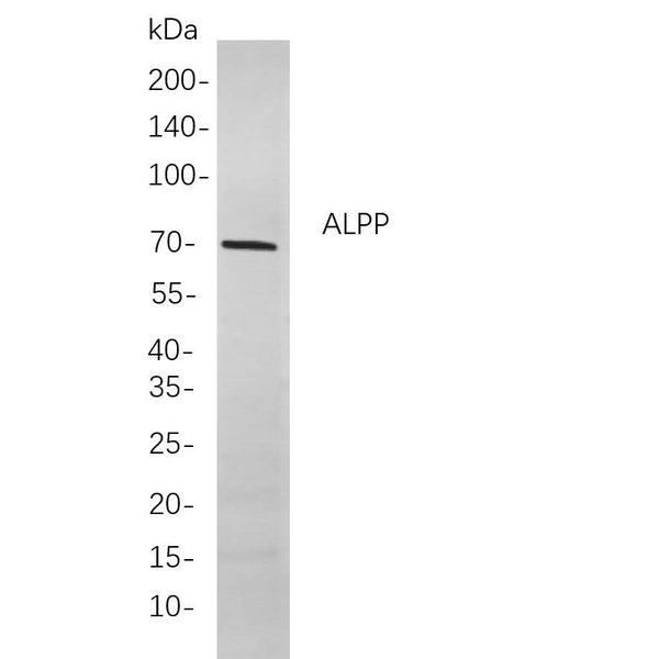U-Blot® ALPP Rabbit Monoclonal Antibody – Figure 1 of 1