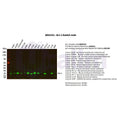 U-Blot® Bcl-2 Rabbit Monoclonal Antibody – Figure 1 of 2