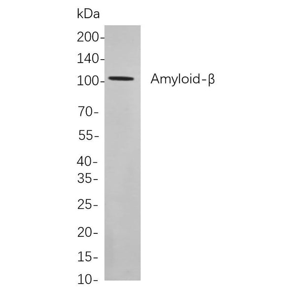 U-Blot® Amyloid-β Rabbit Monoclonal Antibody – Figure 1 of 1