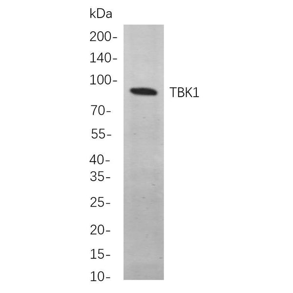 U-Blot® TBK1 Rabbit Monoclonal Antibody – Figure 1 of 1