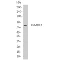 U-Blot® CaMKII β Rabbit Monoclonal Antibody – Figure 1 of 1