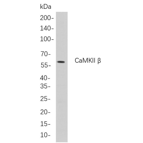 U-Blot® CaMKII β Rabbit Monoclonal Antibody – Figure 1 of 1