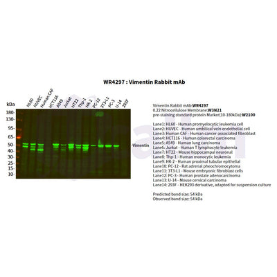 U-Blot® Vimentin Rabbit Monoclonal Antibody – Figure 1 of 3