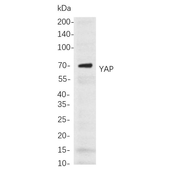 U-Blot® YAP Rabbit Monoclonal Antibody – Figure 1 of 1