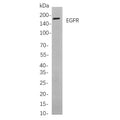 U-Blot® EGFR Rabbit Monoclonal Antibody – Figure 1 of 1