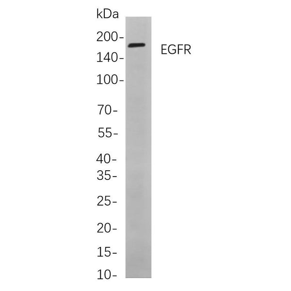 U-Blot® EGFR Rabbit Monoclonal Antibody – Figure 1 of 1