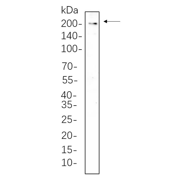 U-Blot® CD206/MRC1 Rabbit Monoclonal Antibody – Figure 1 of 1