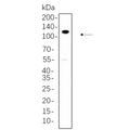 U-Blot® PI3-Kinase p110 β Rabbit Monoclonal Antibody – Figure 1 of 1