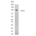 U-Blot® Catenin δ-1 Rabbit Monoclonal Antibody – Figure 1 of 1