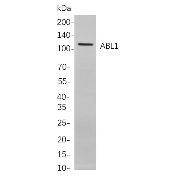 U-Blot® ERK5 Rabbit Monoclonal Antibody – Figure 1 of 1
