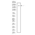 U-Blot® DNMT1 Rabbit Monoclonal Antibody – Figure 1 of 1